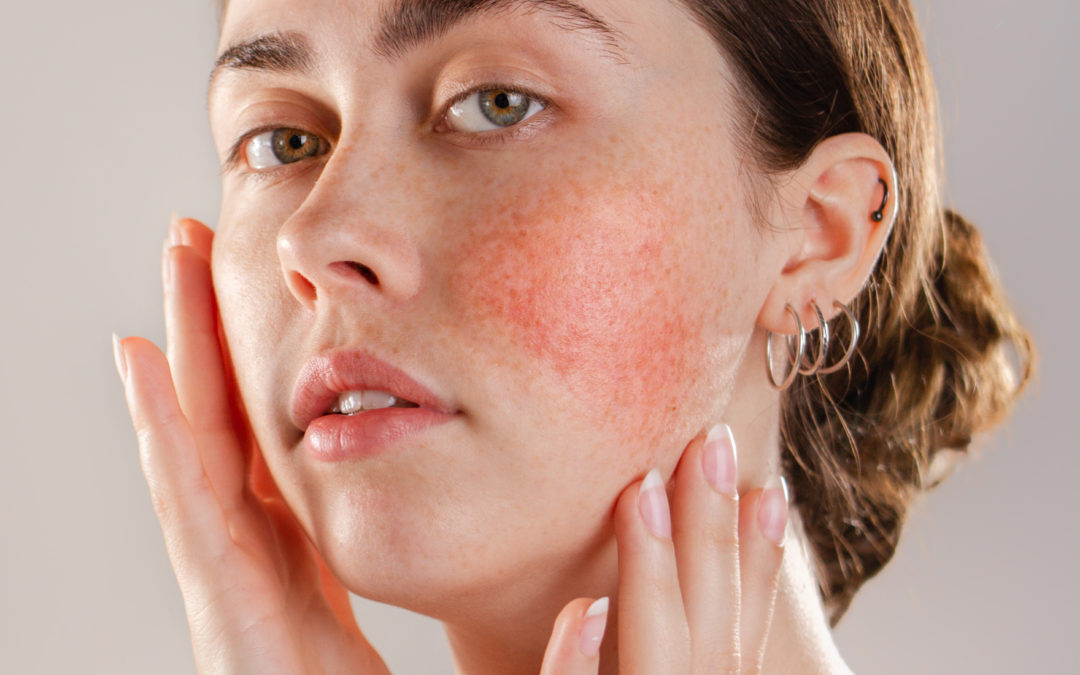 Understanding Common Skin Conditions and When to Seek Dermatology Care