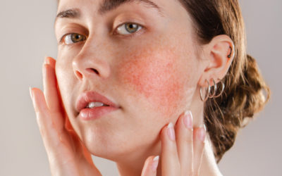 Understanding Common Skin Conditions and When to Seek Dermatology Care