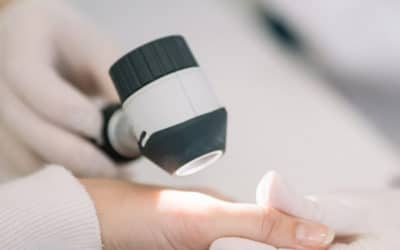 Is It Time for a Mole Check? What Boise Patients Should Know