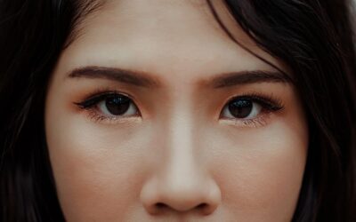 Acne Treatment in the Treasure Valley: Options That Actually Work